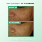 Visibly improves the look of dark marks 